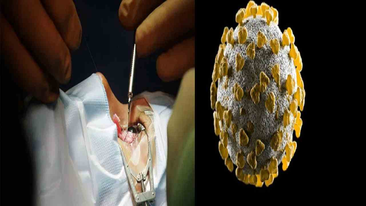 Rewa में Black Fungus के डर से अस्पताल नहीं आ रहे मरीज, जो भर्ती है ऑक्सीजन से भाग रहे